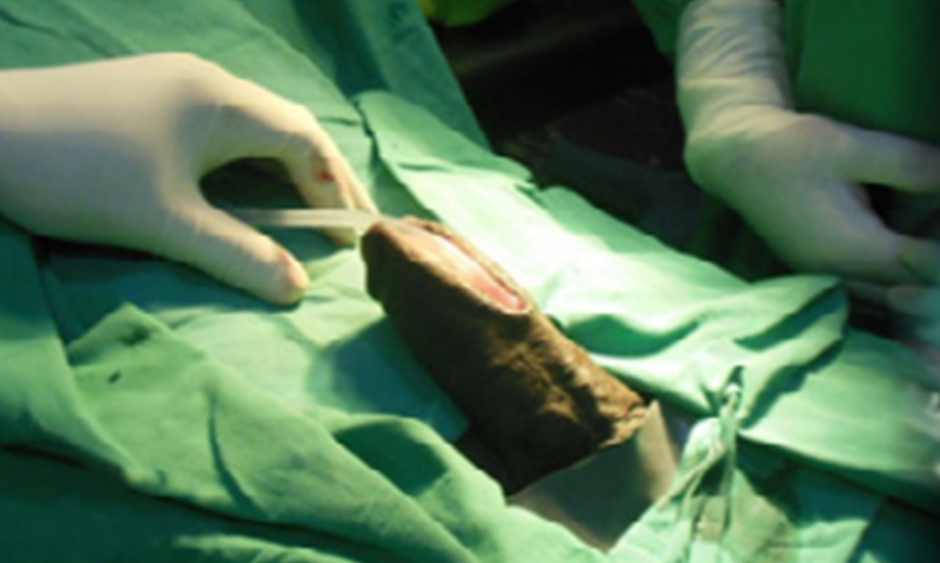 F3-Aetiology-and-Evaluation-940x563